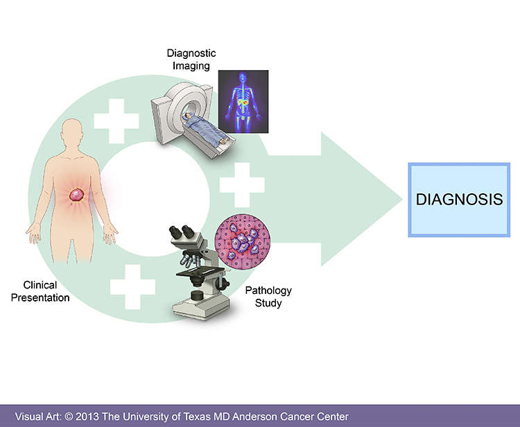 Cancer of Unknown Primary Diagnosis MD Anderson Cancer Center